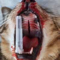 Dil Damak Diyafram Yırtığı Operasyonu 2