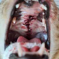 Dil Damak Diyafram Yırtığı Operasyonu 3