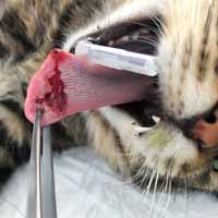 Dil Damak Diyafram Yırtığı Operasyonu 4