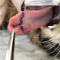 Dil Damak Diyafram Yırtığı Operasyonu 6