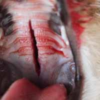 Dil Damak Diyafram Yırtığı Operasyonu 1