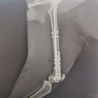 Femur Kırığı Operasyonu 2