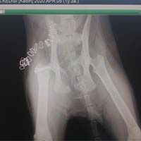 Femur Kırığı Operasyonu 4