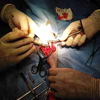 Femur Kırığı Operasyonu 9