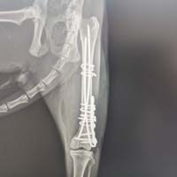 Femur Kırığı Operasyonu 1