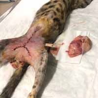 Meme Tümörü Operasyonu 3