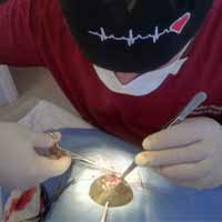 Meme Tümörü Operasyonu 8