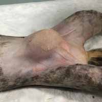 Meme Tümörü Operasyonu 1