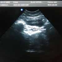 Perineal Üretrostomi 1