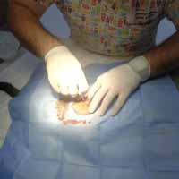 Torakosentez Operasyonu 5