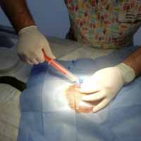 Torakosentez Operasyonu 6