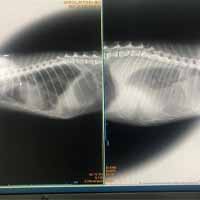 Torakosentez Operasyonu 1