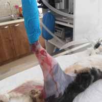 Tibia Kırığı Operasyonu 4