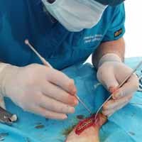 Tibia Kırığı Operasyonu 9