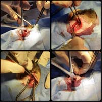 Çene Kırığı Ameliyatı 5