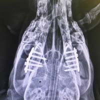 Çene Kırığı Ameliyatı 1